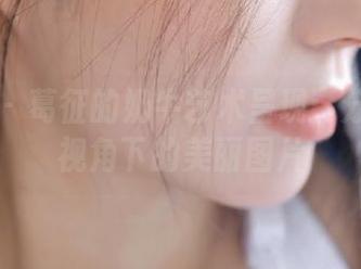 微密圈 – 葛征的奶牛艺术呈现：分享独特视角下的美丽图片